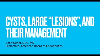 Managing Large quotLesionsquot In Endodontics [upl. by Eiderf]