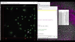 Cellpose  counting frame 2D [upl. by Alesandrini]