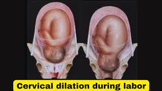 Cervical dilation how to check for laborhow to check if your cervix is dilated [upl. by Kynan347]