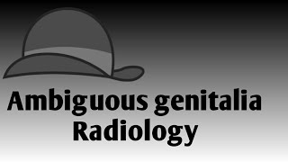 Approach to ambiguous genitalia  Radiology [upl. by Aenej64]