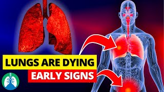 LUNGS are DYING Top 13 Signs of Lung Damage to NEVER IGNORE [upl. by Llerroj209]