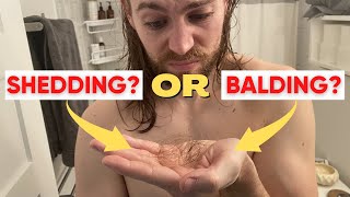 Are You Shedding Or Balding Telogen Effluvium Vs Male Pattern Baldness [upl. by Adirahs]