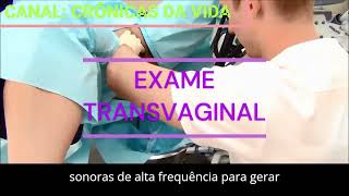 Ultrassom transvaginal o que é como é feito e para que serve [upl. by Hgielah]