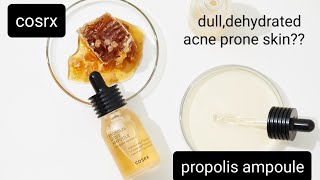 Cosrx propolis light ampoule review in urduhindi best serum for acnedehydrated amp sensitive skin [upl. by Kellda703]