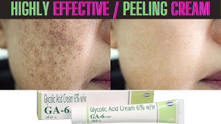 Glycolic Acid Peeling Cream  Highly Effective Result  Skin Whitening [upl. by Rizika]