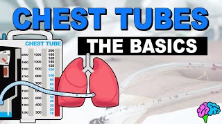 The Basics of Chest Tube Management [upl. by Ripp]