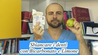 video sbiancamento [upl. by Ihpen]