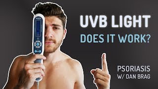 UVB Light Removed 97 Of My Psoriasis [upl. by Rod]