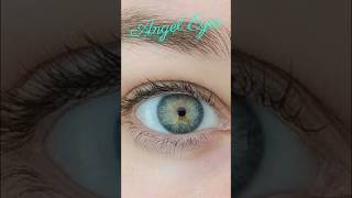 Angle Eyes 👁️ Central Heterochromia [upl. by Yrrad]