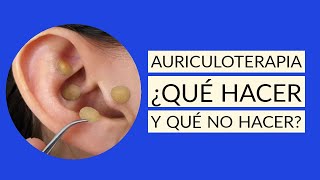 AURICULOTERAPIA aplicacion correcta puntos FUNCIONA 💖👍✨ [upl. by Sinnylg361]