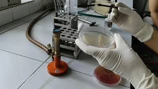 Vibrio cholerae  Cholera red reaction test [upl. by Longfellow]