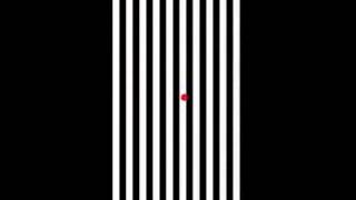 Modified Optokinetic [upl. by Neyr]