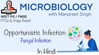 Microbiology 27  Opportunistic Fungal Infections Microbiologywith Manpreet Singh’s Medicine Addict [upl. by Ilojna679]