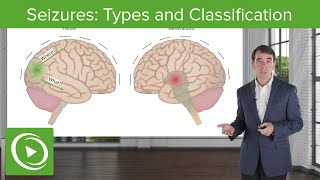 Introduction to Seizure and Epilepsy Diagnosis by Drs A Patel L Sham A Kielian and L Hayes [upl. by Ettenil341]