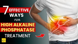 Alkaline Phosphatase EXPERT Shares 7 Proven Treatment Options [upl. by Bamford872]