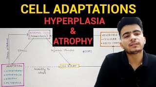 Hyperplasia amp Atrophy  Cell Adaptations 23  General Pathology  EOMS [upl. by Hahnke]