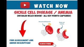 SICKLE CELL DISEASE  ANEMIA  DETAILED NCLEXRN REVIEW [upl. by Gaskin]