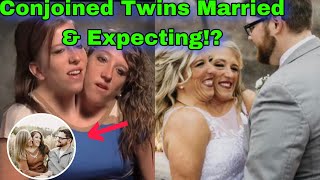 Brittany amp Abby Conjoined Twins Major Update Married amp What Else [upl. by Janeta571]