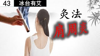 艾灸养生43 肩周炎胳膊疼该怎么办？还在吃止痛药？一个解决肩周炎五十肩不用打针吃药的方法，艾灸帮你摆脱你的肩周炎。Periarthritis of the shoulder treatment [upl. by Butte]