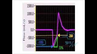 APRV Setting TLow based on the expiratory flow waveform [upl. by Drareg]