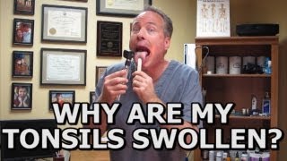 Natural Solutions For Swollen Tonsils How To Avoid A Tonsillectomy Common Sense Medicine [upl. by Daney]