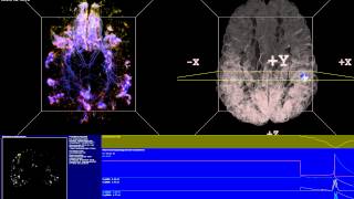 Thalamocortical Loops  Spiking Neural Network Simulation [upl. by Mowbray]