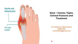 Gout  Types Clinical Features and Treatment  Hyperuricemia  Uric Acid  Biochemistry [upl. by Georgetta673]