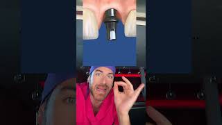 Voici 3 solutions pour remplacer une dent manquante shorts [upl. by Windham40]