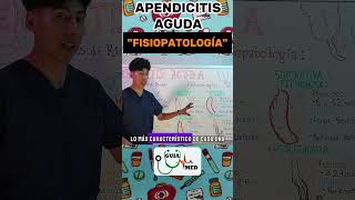 APENDICITIS AGUDA FISIOPATOLOGÍA  GuiaMed Apendicitis ApendicitisAguda [upl. by Zita]