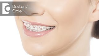 Orthodontic management of Mouth Breathing  Dr Sana Taher [upl. by Endora]