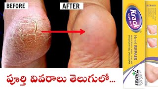 Krack Heel Repair Cream Uses in TeluguHow to Apply Krack CreamBest cream For Heals in Telugu [upl. by Rett86]