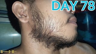 DAY 78  KIRKLAND MINOXIDIL BEARD JOURNEY [upl. by Hadrian836]