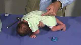 physical exam Newborn Normal Primitive Reflexes  Galant [upl. by Justine]