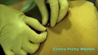 Piercing Ombligo Navel Piercing [upl. by Nnoryt421]