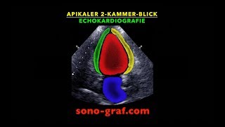 Echokardiografie  Apikaler Zweikammerblick [upl. by Eeliab]