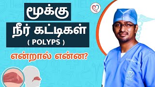 மூக்கு நீர் கட்டிகள் polyps என்றால் என்ன   Nasalpolyps Dr Manoj ENT Speciality Centre  Trichy [upl. by Given]