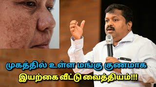 முகத்தில் உள்ள மங்கு கருமை நீங்கி பளபளப்பாக  DrSivaraman  Remedy for face darknessblack spots [upl. by Lolande]