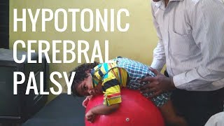 Hypotonic Cerebral Palsy Home Tips amp Physiotherapy [upl. by Nnayar274]