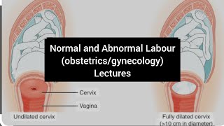 Dysfunctional uterine contractions and its management Abnormal labour part 8  obstetrics chapter12 [upl. by Asus274]