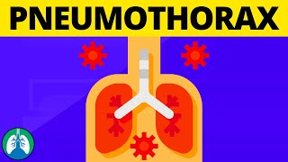 Signs of a Pneumothorax TMC Practice Question  Respiratory Therapy Zone [upl. by Crow]