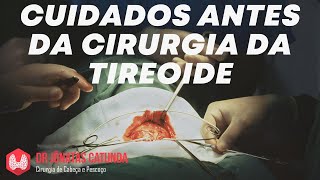 O que fazer enquanto aguarda a cirurgia da tireoide [upl. by Onibla]