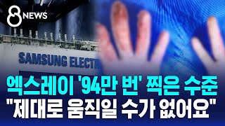 엑스레이 94만 번 찍은 수준…quot제대로 움직일 수가 없어요quot  SBS 8뉴스 [upl. by Carmon]