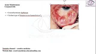 Lec 2 Acute Membranous Conjunctivitis mp4  OPHTHALMOLOGY [upl. by Duquette]