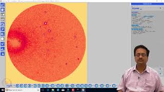 Understanding the XRay Data [upl. by Aneerahs]