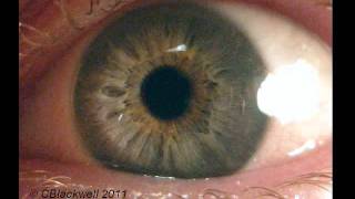 Eye Works 1 Focusing Cornea Iris and Lens [upl. by Aseram]