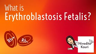 Erythroblastosis Fetalis In Hindi  Haemolytic Disease  Science Guru Ravi [upl. by Rakso]