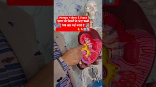 Human Kidney amp Renal Stone  इंसान की किडनी के अंदर पथरी कैसे और कहाँ बनती है viral shorts kidney [upl. by Broome268]