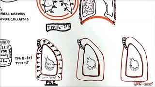 Transmural Pressures transpulmonary transthoracic transrespiratory pressure [upl. by Yelyk49]