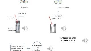 Occlusion en Prothèse sur implants [upl. by Ahsenid]