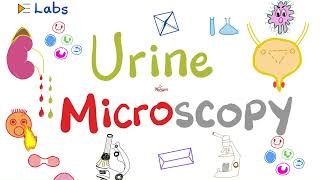 Urine Microscopic Examination  RBCs WBCs Tubular Casts  Urinalysis  Labs [upl. by Irelav646]